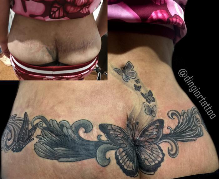 Tattoo cover up Scar Blackwork